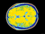Buy Human Brain Normal CT Scan at AllPosters.com