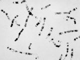Buy Human Chromosomes, Free Showing Banding at AllPosters.com