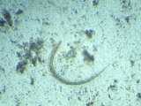 Photomicrograph Hookworm Larval Stage