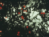 Buy Bone Marrow Blood Smear X100 at AllPosters.com
