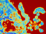 Buy Hantavirus X88,000 Mag Tem Sin Nombre Virus at AllPosters.com