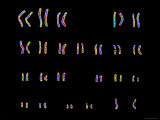 Buy Karyotype Color Normal Female Child at AllPosters.com