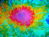 Ophthalmic Fundus