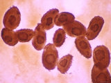 Tetrahymena Thermophila X125