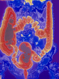 Buy Female GI Tract Enhanced Radiograph at AllPosters.com