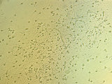 Normal Human Sperm