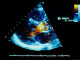 Historical Ultrasound of Heart Ultrasound