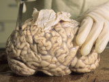 Buy Hospital Morgue Preparing Brain for Autopsy at AllPosters.com