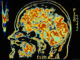 Buy Digitized MRI Sagittal, Human Head at AllPosters.com