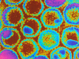 Buy Herpes Simplex Viruses Color Em at AllPosters.com