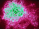Buy Hepatitis B Virus at AllPosters.com