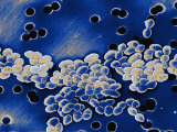 Buy Vancomycin Resistant Enterococci at AllPosters.com