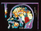 Buy Digitized MRI Brain, Lateral View at AllPosters.com