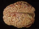 Buy Human Brain, Specimen Cerebral Hemispheres View at AllPosters.com