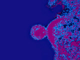 Buy HIV AIDS Virus. Acquired Immune Deficiency Syndrome at AllPosters.com