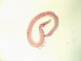 Shistosoma Mansoni Blood Fluke Parasite