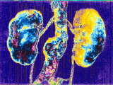 Buy Kidneys of Kidneys at AllPosters.com