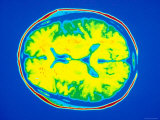Buy Normal Cat Scan Computed Aided Tomography at AllPosters.com