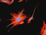Buy Mammalian Nerve Cells Dendrite Sensory Synapse at AllPosters.com