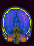 Buy Brain Hemispheres Visible Colorized MRI Normal at AllPosters.com