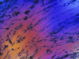 Buy Dental Plaque X100 at AllPosters.com