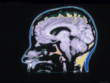 Buy Color MRI Scan Head Skull Brain Normal X-Ray at AllPosters.com