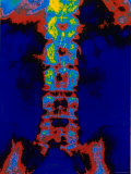 Digitized Radiograph Spine Pelvis X-Ray