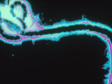 Ebola Virus Micrograph Enhansed