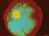 Ophthalmic Image of Retina Normal