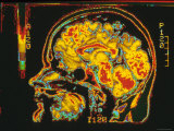 Buy Magnetic Resonance Imaging Lateral View of Head at AllPosters.com