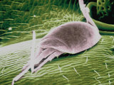 Parasite on Ant's Head Peudocolorized Sem X482