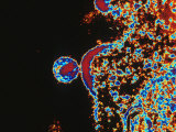 Buy AIDS Virus at AllPosters.com