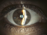 Buy Ophthalmic Camera Slit Lamp Photography at AllPosters.com
