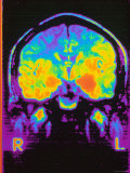 Buy Magnetic Resonance Imaging MRI of Head at AllPosters.com
