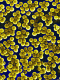 Buy Methicillin Resistant Staphylococcus Aureus, MRSA at AllPosters.com