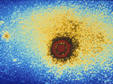 Buy Rhinovirus Common Cold Type 1A Mag X100000 at AllPosters.com