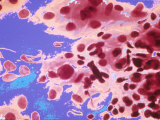 Buy Pap Smear Cervical Cells at AllPosters.com