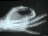 Buy X-Ray Normal Hand Pinch Study at AllPosters.com