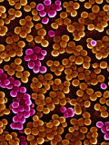 Buy MRSA Infections Occur Most Frequently in Hospitals and Healthcare at AllPosters.com