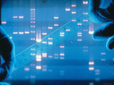 DNA Fingerprinting Closeup Electrophoresis