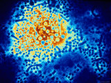 Hepatitis B Virus Electron Micrograph Tem