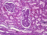 Buy Kidney Glomerulus and Tubules X200 at AllPosters.com
