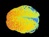 Buy Human Brain Image at AllPosters.com