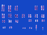 Buy Normal Male Karyotype Paired Chromosomes at AllPosters.com