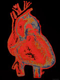 Human Heart
