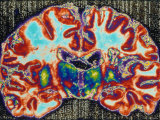 Brain Section, Cerebellum Section