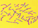 Buy Human Chromosomes Normal Karyotype at AllPosters.com