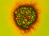 Buy Hepatitis A Viruses X225,000 at AllPosters.com