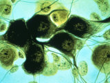 Neurons by Brightfield Microscope
