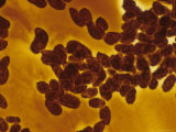 Tetrahymena Thermophila X60